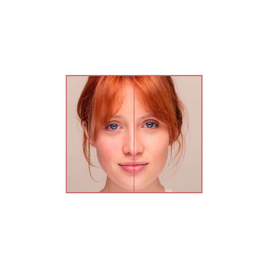 Isdin Fotoultra Redness SPF50 50 ml antes y despues