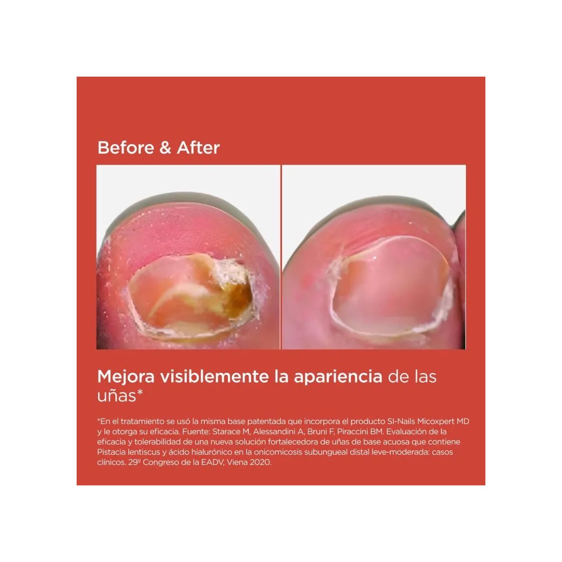 Isdin Si-Nails Microexpert 4,5 Ml resultados