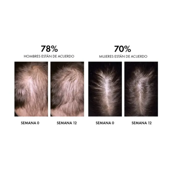 Dercos Aminexil Clinical REGEN BOOSTER Sérum Capilar 90 Ml resultados