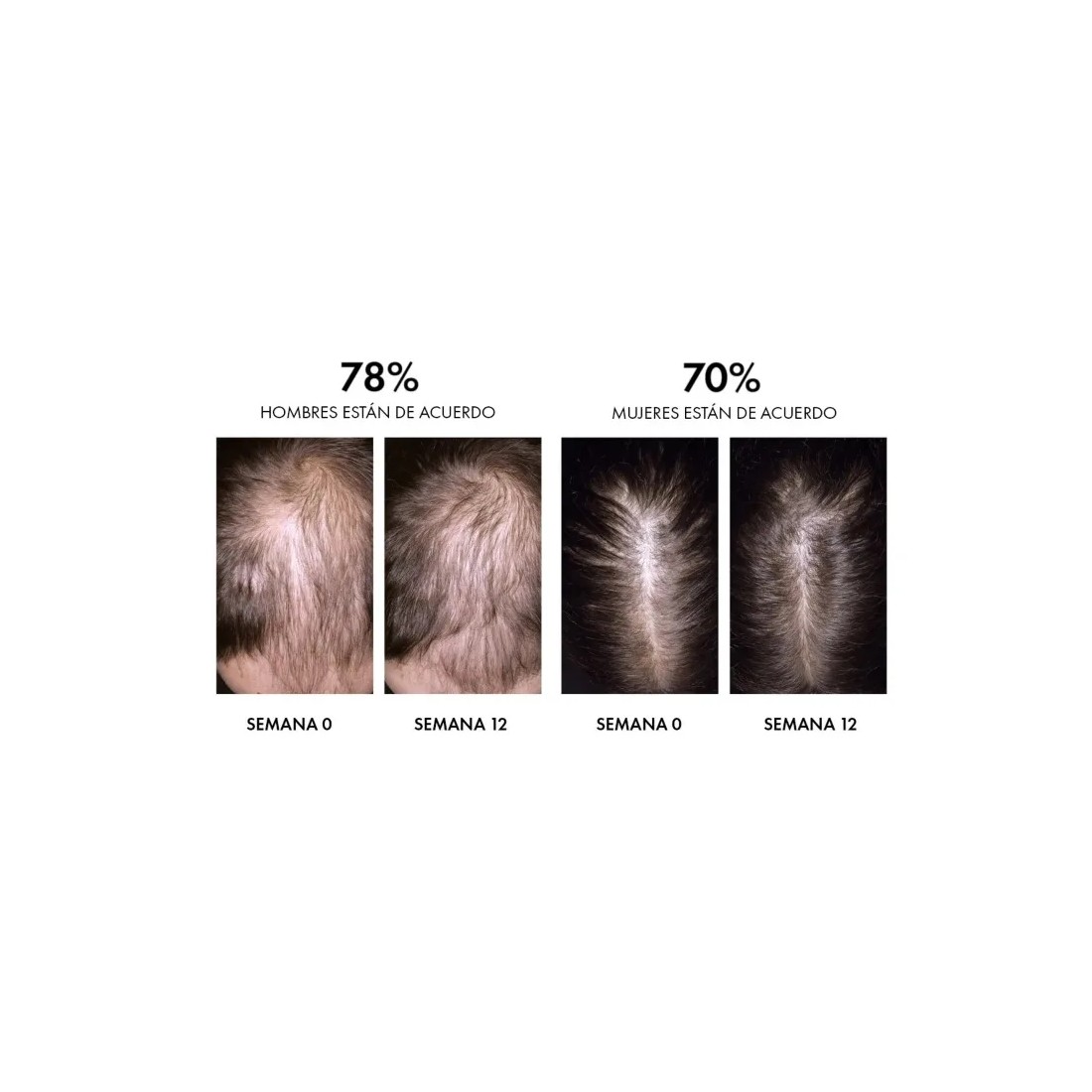 Dercos Aminexil Clinical REGEN BOOSTER Sérum Capilar 90 Ml resultados
