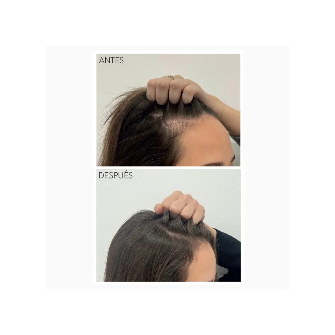 Moncho Moreno Tratamiento Rapunhair 70 Ml efectos