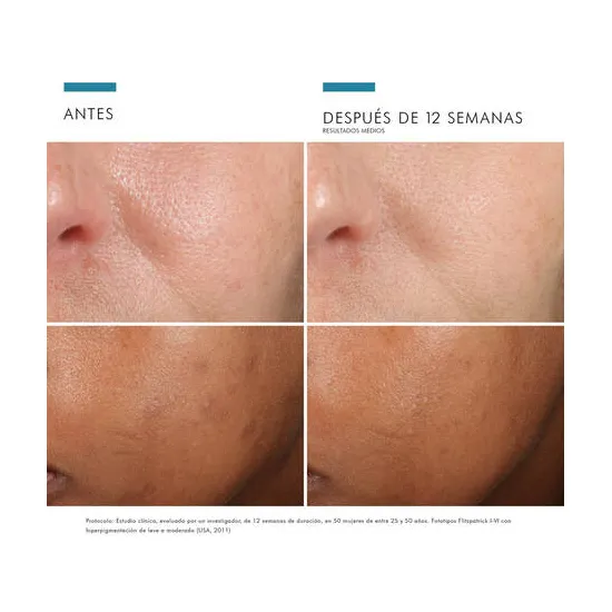 SkinCeuticals Phloretin CF Sérum Vitamina 30 ml resultados
