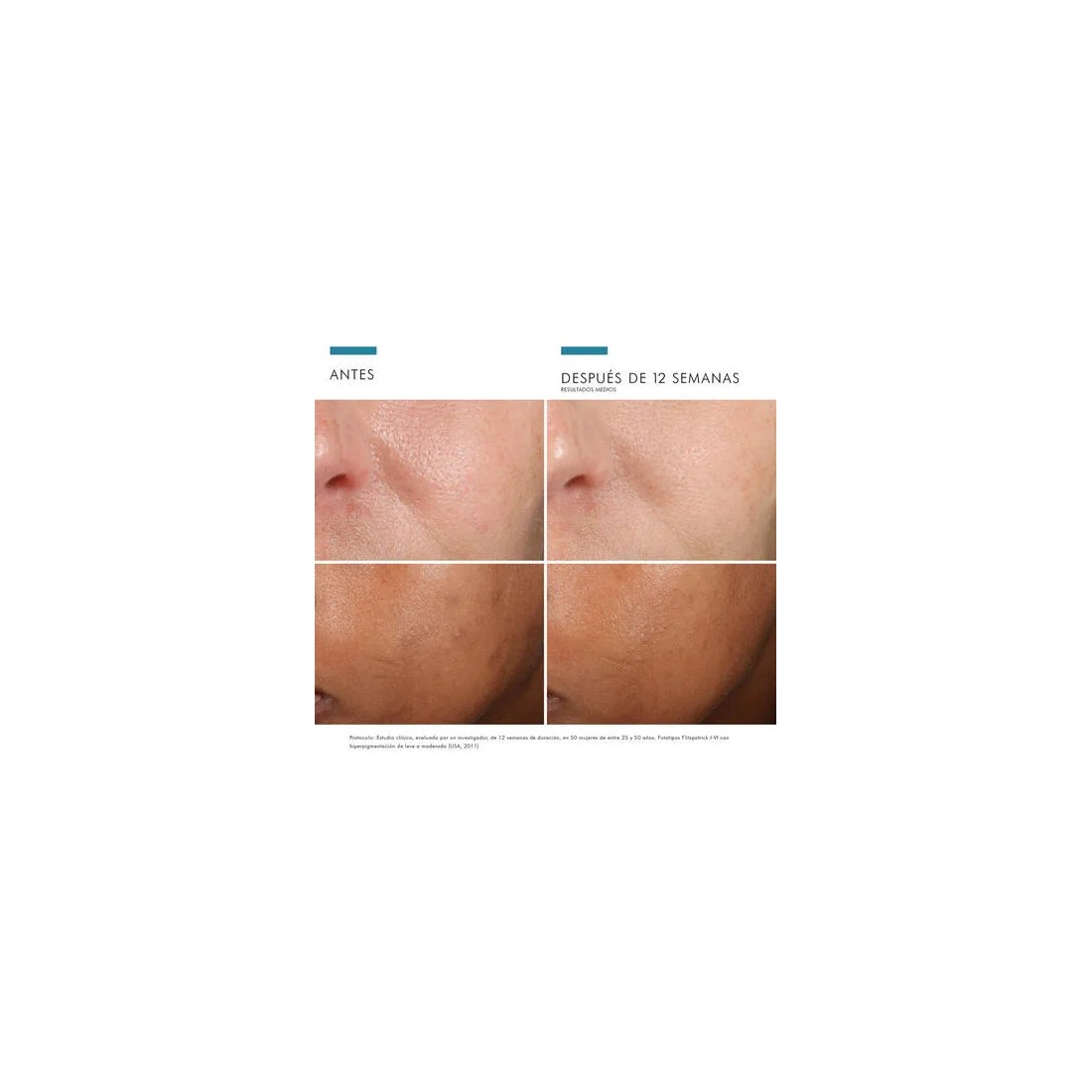 SkinCeuticals Phloretin CF Sérum Vitamina 30 ml resultados