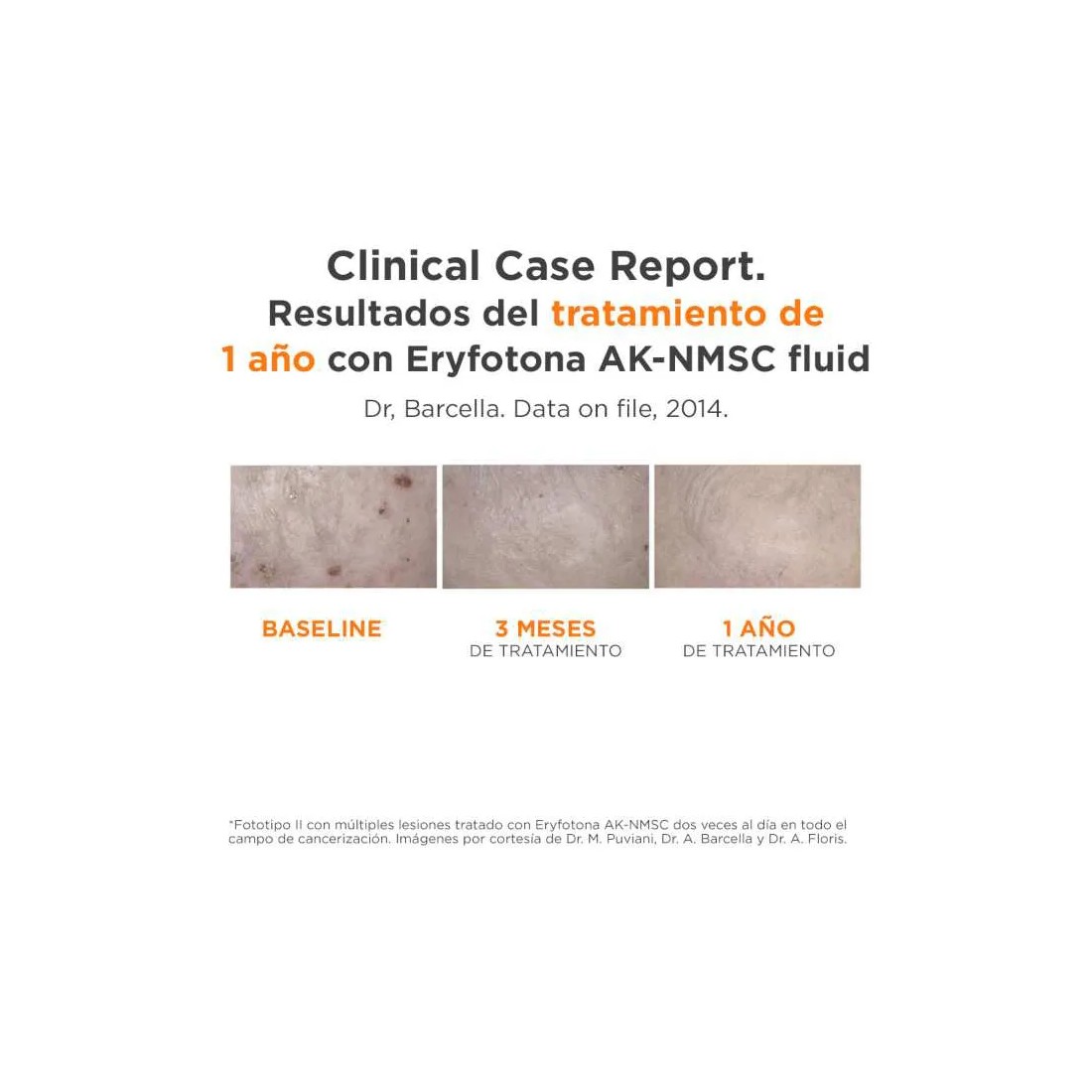 Isdin Eryfotona Ak-Nmsc fluido 50 ml avances