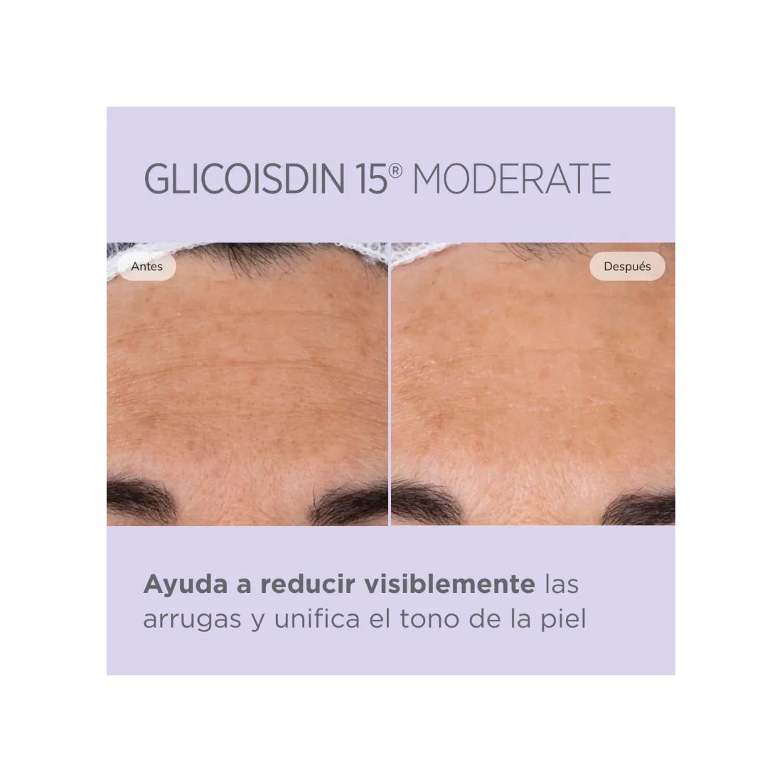 isdinceutics glicoisdin moderado eficacia